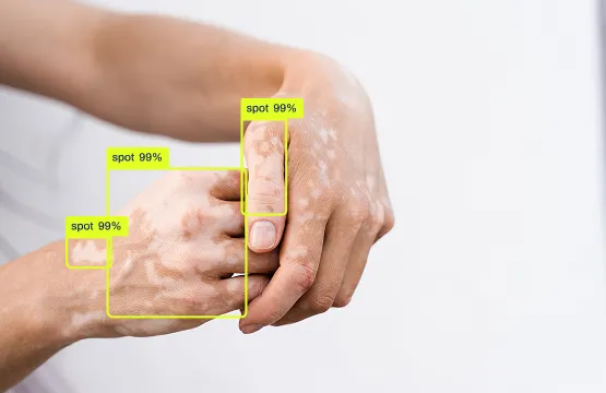 Object detection